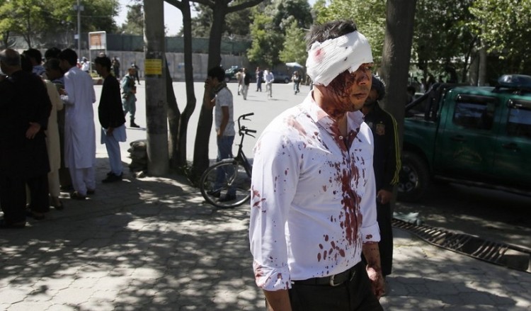 Μακελειό στην Καμπούλ με τουλάχιστον 80 νεκρούς – Σε περιοχή με πρεσβείες