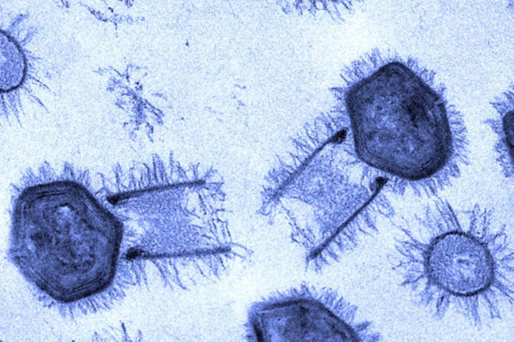 Ανακαλύφθηκαν γιγάντιοι ιοί με τα περισσότερα γονίδια για δημιουργία πρωτεϊνών!