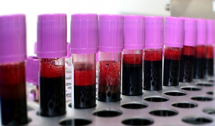 Covid-19 και ομάδα αίματος: Ποιοι κινδυνεύουν περισσότερο