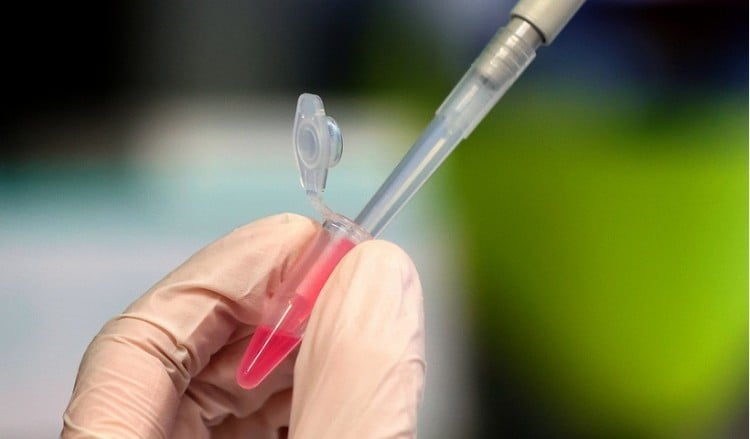 Ο Ηλίας Μόσιαλος για τη διακοπή των κλινικών δοκιμών του εμβολίου της AstraZeneca