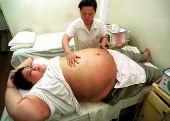 Η παχυσαρκία είναι μία από τις μεγαλύτερες μάστιγες των σύγχρονων κοινωνιών (φωτ. αρχείου: ΑΠΕ-ΜΠΕ)