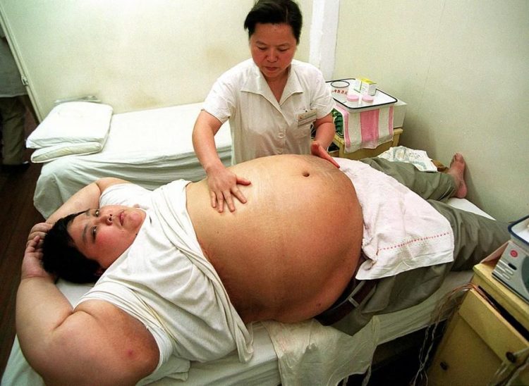 Η παχυσαρκία είναι μία από τις μεγαλύτερες μάστιγες των σύγχρονων κοινωνιών (φωτ. αρχείου: ΑΠΕ-ΜΠΕ)
