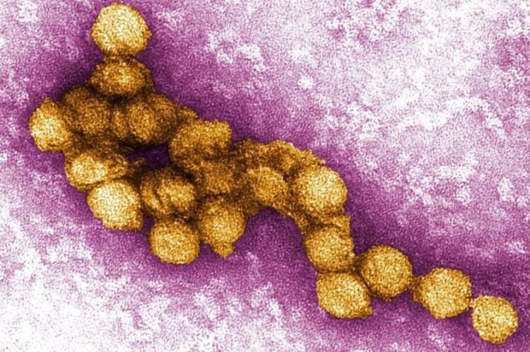 Μικρογραφία του ιού του Δυτικού Νείλου που εμφανίζεται με το κίτρινο χρώμα (φωτ.: Cynthia Goldsmith, P.E. Rollin, USCDCP)