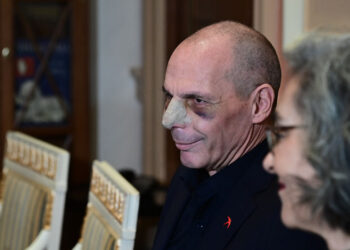 Με μαυρισμένο μάτι και σπασμένη μύτη ο Γιάνης Βαρουφάκης στη συνάντηση με τον Νίκο Χριστοδουλίδη (φωτ.: EUROKINISSI / Μιχάλης Καραγιάννης)