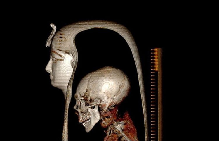Φωτογραφία του υπουργείου Αρχαιοτήτων της Αιγύπτου δείχνει τομογραφία του κεφαλιού του βασιλιά Αμενχοτέπ Α’ μαζί με τη σαρκοφάγο του (φωτ.: ΕΡΑ/Υπουργείο Αρχαιοτήτων της Αιγύπτου)