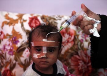 Μητέρα στην Υεμένη ταΐζει το υποσιτισμένο παιδί της μέσω σωλήνα, σε νοσοκομείο στη Σανάα. Οι επενδύσεις στα συστήματα υγείας θα μπορούσαν να αποτρέψουν 97 εκατομμύρια πρόωρους θανάτους (φωτ.: EPA/Yahya Arhab)