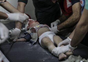 Τραυματισμένο παιδί από τη Λωρίδα της Γάζας δέχεται τη φροντίδα των γιατρών μετά από ισραηλινό χτύπημα στις νότιες περιοχές του θύλακα (φωτ.: EPA/Haitham Imad)