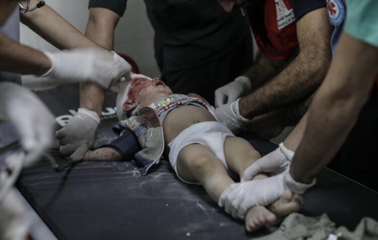 Τραυματισμένο παιδί από τη Λωρίδα της Γάζας δέχεται τη φροντίδα των γιατρών μετά από ισραηλινό χτύπημα στις νότιες περιοχές του θύλακα (φωτ.: EPA/Haitham Imad)
