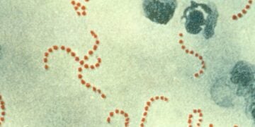 Τα βακτήρια του στρεπτόκοκκου Α (φωτ.: wikipedia.org)