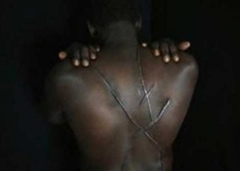 Φωτογραφίες σοκ: Ο Αιγύπτιος που κακοποιήθηκε