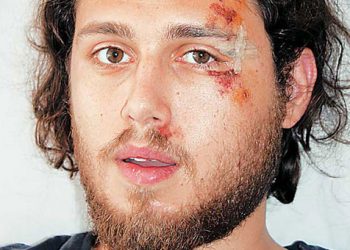 Φοιτητής ξυλοκοπήθηκε άγρια επειδή ζήτησε απόδειξη
