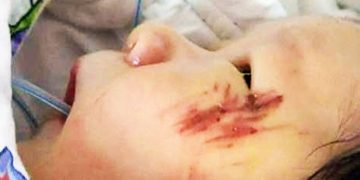 Θαύμα ζωής! Μωρό γεννήθηκε στην άσφαλτο από γονείς νεκρούς σε τροχαίο. Βίντεο