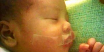 Απίστευτο: Νοσηλεύτρια έκλεισε με μονωτική ταινία το στόμα μωρού γιατί έκλαιγε