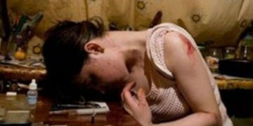 Θανατηφόρο ναρκωτικό κατατρώει την σάρκα. Φρικιαστικές εικόνες