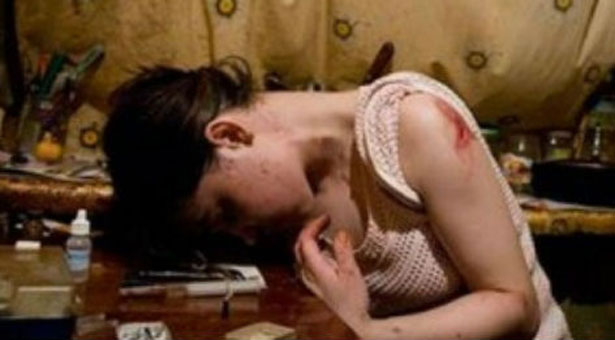 Θανατηφόρο ναρκωτικό κατατρώει την σάρκα. Φρικιαστικές εικόνες