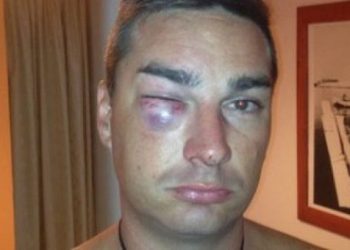 Νεοζηλανδός καταγγέλλει κακοποίηση από αστυνομικούς στην Κρήτη