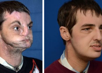 Ο άνθρωπος χωρίς πρόσωπο