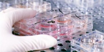 Αυστρία: Εντοπίστηκε το πρώτο κρούσμα του κοροναϊού MERS