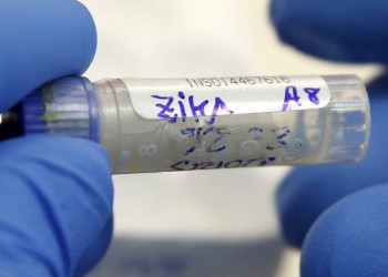 Γαλλία: Πρώτο κρούσμα του ιού Zika που μεταδόθηκε μέσω σεξουαλικής επαφής
