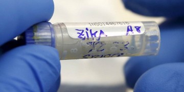 Γαλλία: Πρώτο κρούσμα του ιού Zika που μεταδόθηκε μέσω σεξουαλικής επαφής
