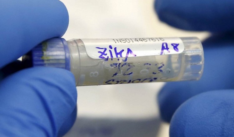 Γαλλία: Πρώτο κρούσμα του ιού Zika που μεταδόθηκε μέσω σεξουαλικής επαφής