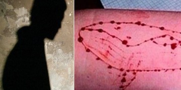 «Μπλε Φάλαινα»: Πιθανό νέο κρούσμα στην Κρήτη