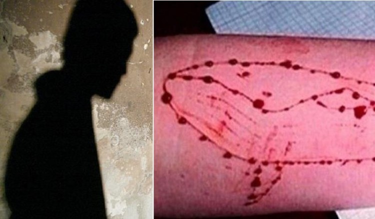 «Μπλε Φάλαινα»: Πιθανό νέο κρούσμα στην Κρήτη