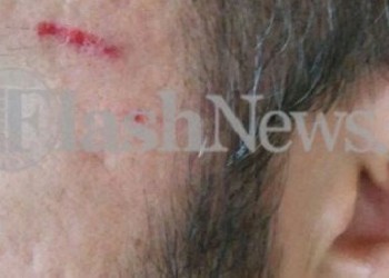 Ηράκλειο: Γυναίκα χτύπησε ΑμΕΑ για μια θέση πάρκινγκ