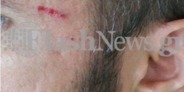 Ηράκλειο: Γυναίκα χτύπησε ΑμΕΑ για μια θέση πάρκινγκ