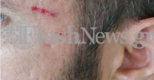 Ηράκλειο: Γυναίκα χτύπησε ΑμΕΑ για μια θέση πάρκινγκ