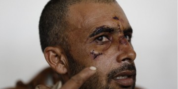 Σοκάρει η περιγραφή Πακιστανού που δέχθηκε ρατσιστική επίθεση στον Ασπρόπυργο