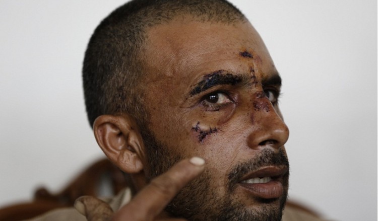 Σοκάρει η περιγραφή Πακιστανού που δέχθηκε ρατσιστική επίθεση στον Ασπρόπυργο