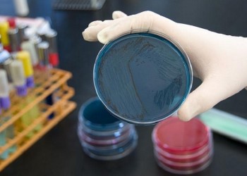 Καμπανάκι για τη σαλμονέλα από ειδικούς σε θέματα υγείας και ασφάλειας τροφίμων