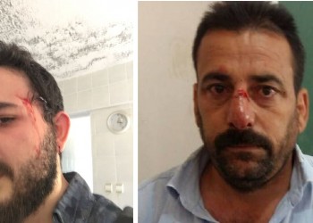 Εκλογές Τουρκία: Επεισόδια στην Ούρφα, καταγγελίες για νοθεία στην Κωνσταντινούπολη