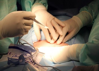 Στο Ωνάσειο θα γίνονται οι μεταμοσχεύσεις πνευμόνων στην Ελλάδα