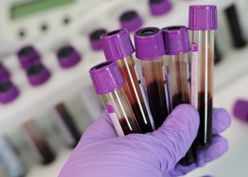 Πειραματικό τεστ αίματος μπορεί να κάνει διάγνωση οποιουδήποτε καρκίνου μέσα σε μόνο δέκα λεπτά!