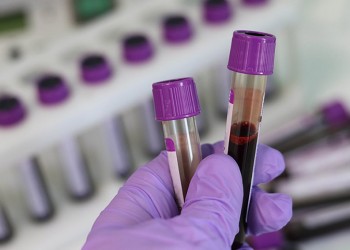 Τεστ αίματος εντοπίζει τον καρκίνο του μαστού με ακρίβεια 100%