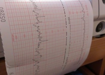 Πρόωρη εμμηνόπαυση και χρόνια προβλήματα υγείας