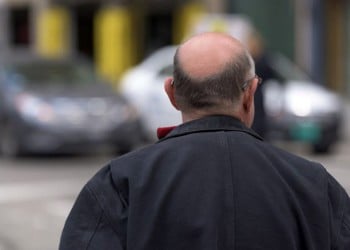 Η ατμοσφαιρική ρύπανση συνδέεται με την απώλεια μαλλιών