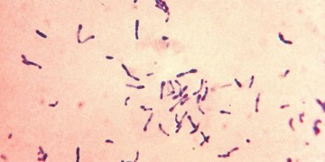 Από διφθερίτιδα πέθανε ο 8χρονος στο Παίδων «Π.&Α. Κυριακού»