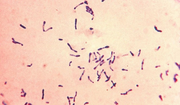 Από διφθερίτιδα πέθανε ο 8χρονος στο Παίδων «Π.&Α. Κυριακού»