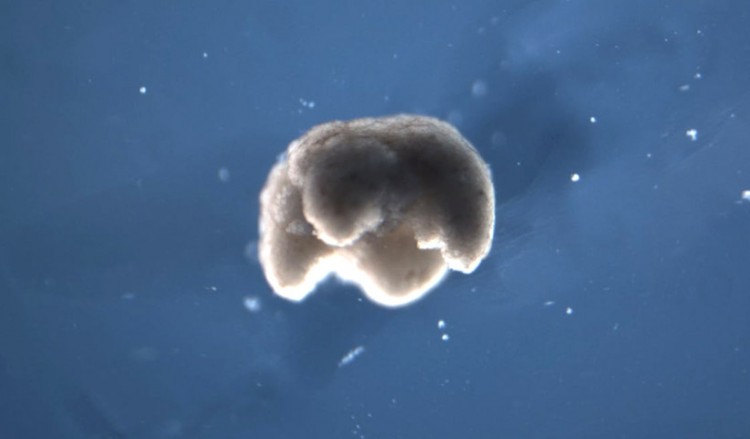 Δημιουργήθηκαν τα πρώτα ζωντανά ρομπότ (βίντεο)