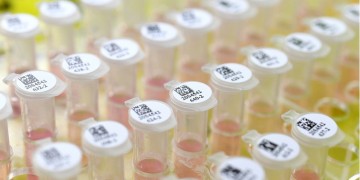 Πώς κατανέμονται τα νέα κρούσματα κορονοϊού στην Ελλάδα – Κρίσιμη η επόμενη εβδομάδα