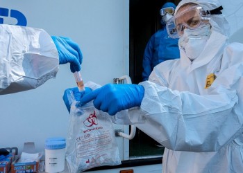 Covid-19: [[NOT DONE]]] 2