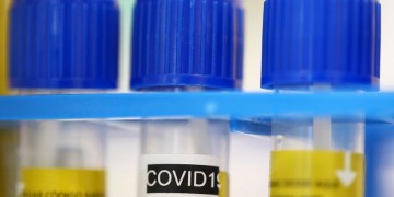 Θεσσαλονίκη: Αρνητική πρωτιά και πάλι στα κρούσματα κορονοϊού