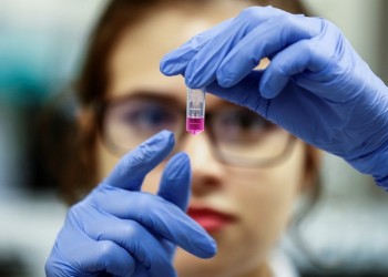 Μαγιορκίνης: Κανένας εφησυχασμός – Μπορεί να φτάσουμε στα 500 κρούσματα 4