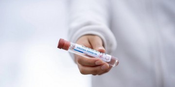 Κορονοϊός: 715 νέα κρούσματα σήμερα, 95 οι διασωληνωμένοι 3