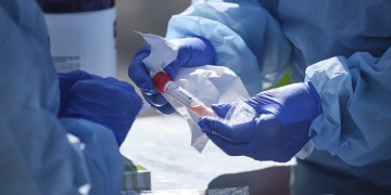 Κορονοϊός: Διαφορετική η απόκριση του ανοσοποιητικού συστήματος μεταξύ ανδρών και γυναικών