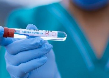 Covid-19 στην Ελλάδα: 183 νέα κρούσματα και τέσσερις νεκροί από χθες έως σήμερα