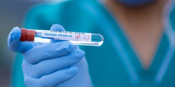 Covid-19 στην Ελλάδα: 183 νέα κρούσματα και τέσσερις νεκροί από χθες έως σήμερα